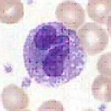 eosinófilo: célula de la sangre eosinófilo: célula de la sangre