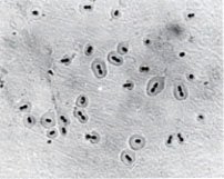 imagen misroscòpica de Streptococcus pneumoniae capsulado